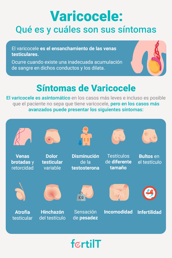 Infografía con definición de varicocele y sus síntomas
