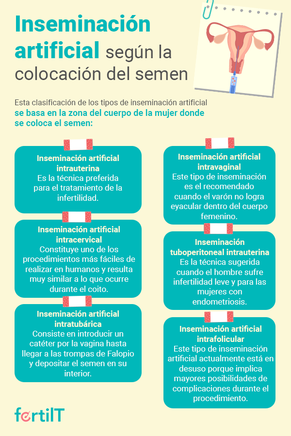 Infografía con los tipos de inseminación artificial según la colocación del semen