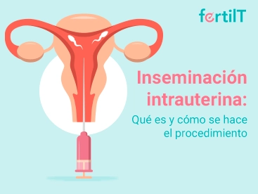 Portada miniatura del artículo Inseminación Intrauterina: Qué es y cómo se hace el procedimiento
