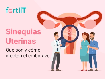 Sinequias Uterinas: qué son y cómo afectan el embarazo