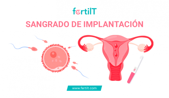 Sangrado De Implantación Qué Es Síntomas Y Cuánto Dura 3589