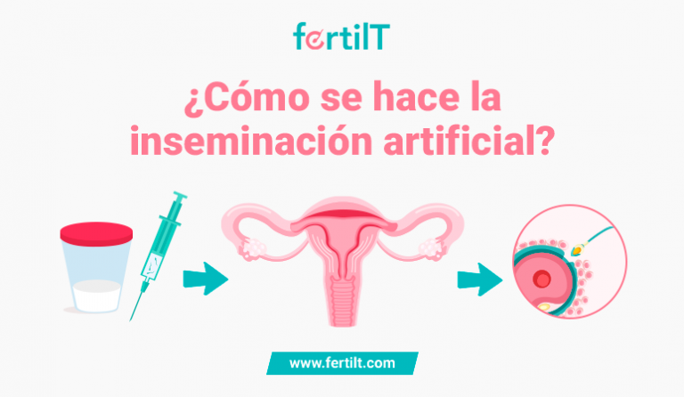 ¿Cómo Se Hace La Inseminación Artificial?