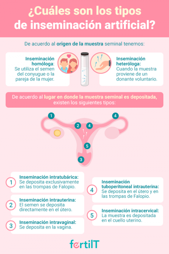 Inseminación Artificial En México. Todo Lo Que Necesitas Saber