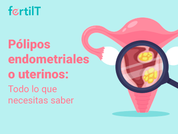 Imagen miniatura del artículo Pólipos endometriales o uterinos todo lo que necesitas saber