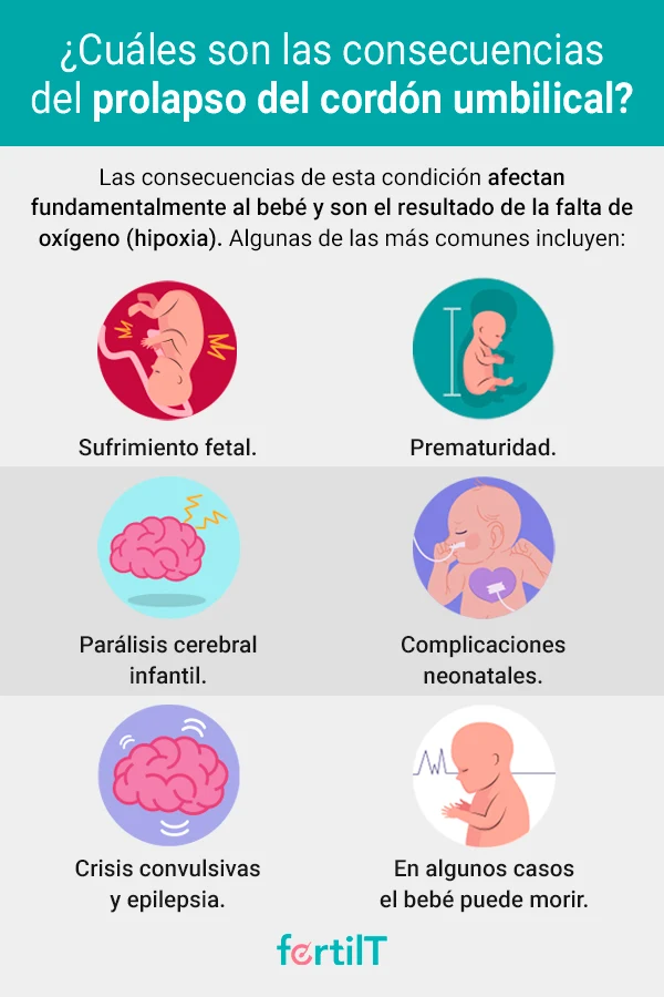 Consecuencias del cordón umbilical prolapsado en infografía de color gris claro 