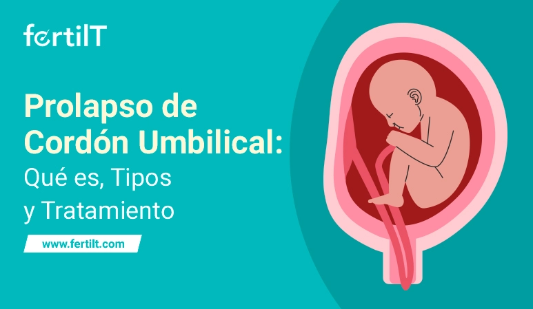 Bebé dentro del útero con prolapso del cordón umbilical