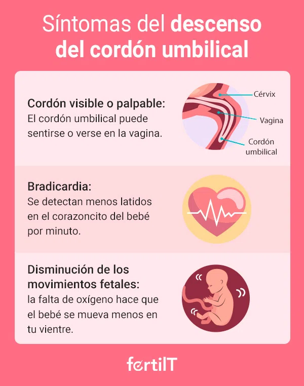 Síntomas del prolapso del cordón umbilical en infografía rosada